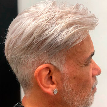 protese-capilar-masculino