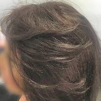 protese-capilar-feminina
