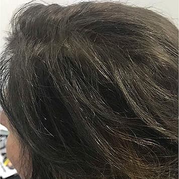 protese-capilar-feminina