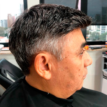 protese-capilar-masculino