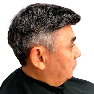 Prótese capilar masculino protese-capilar-masculino